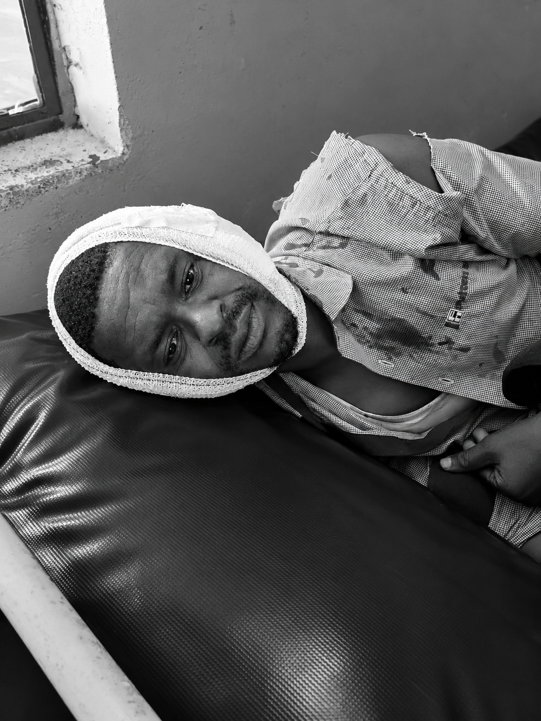 Man Loses Part of Ear in Family Land Dispute in Makueni